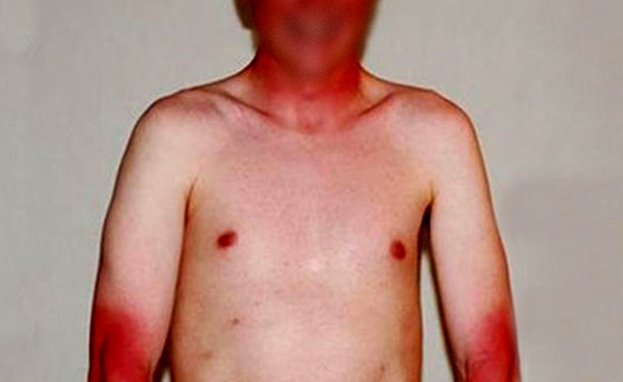 налсовна слика